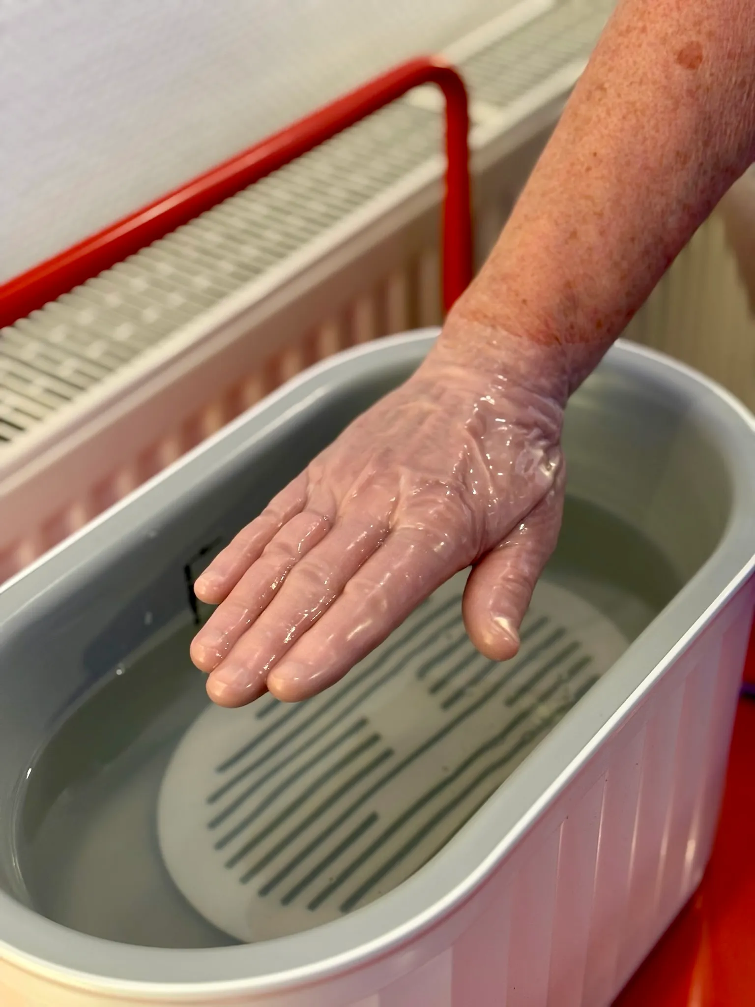 Hand mit geschlossener Paraffinschicht nach dem Bad